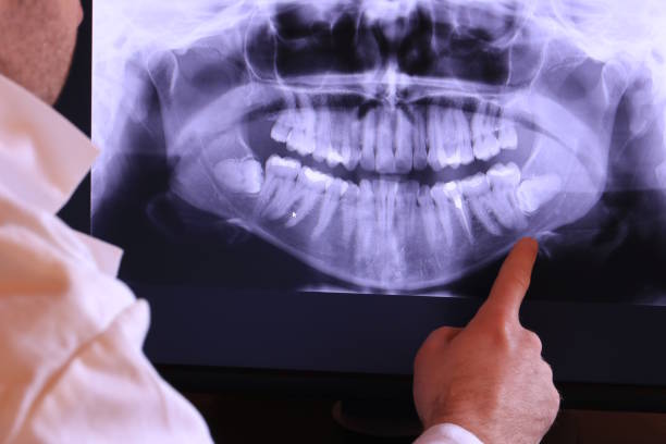 Best Broken Tooth Emergency  in Louisville, TN
