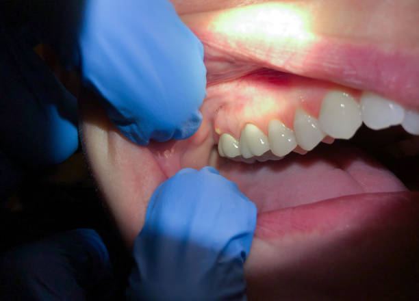 Best Cracked Tooth Emergency Dentist  in Louisville, TN